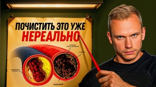 Эти 6 продуктов превратят ваши СОСУДЫ в помойку. Остановитесь!