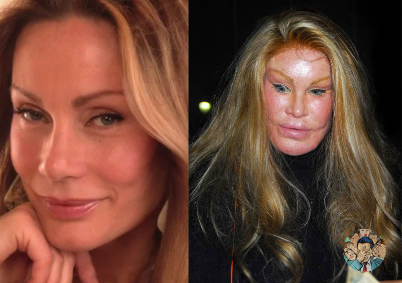 Pin on Plastic Surgery Info