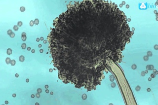 Preventing Aspergillus Niger in Healthcare Environments