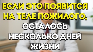 ЕСЛИ ЭТО появляется в ТЕЛЕ ПОЖИЛОГО ЧЕЛОВЕКА… СМЕРТЬ может быть уже БЛИЗКО